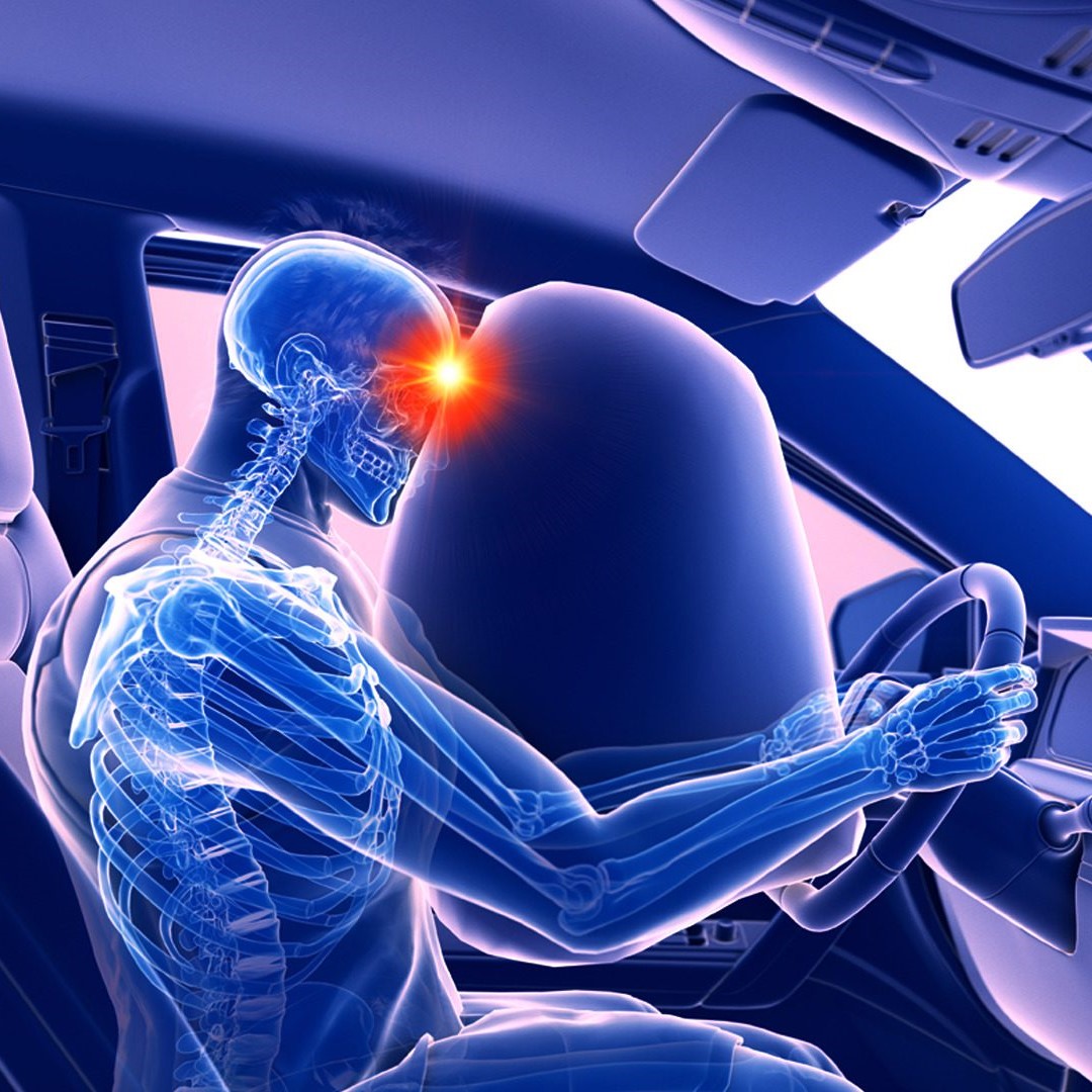 airbag deployment